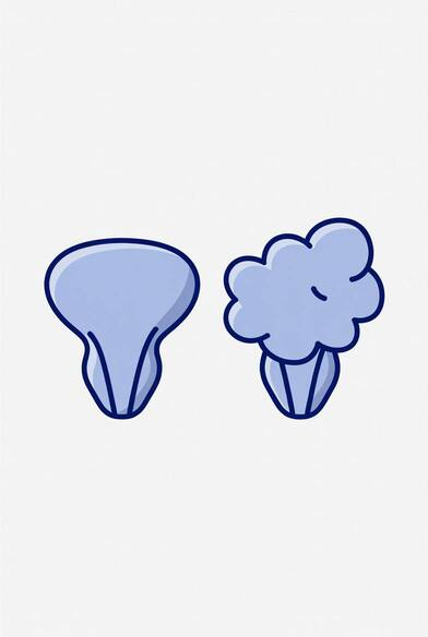 Что такое рак простаты