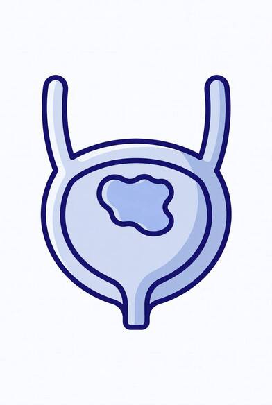 Что такое рак мочевого пузыря